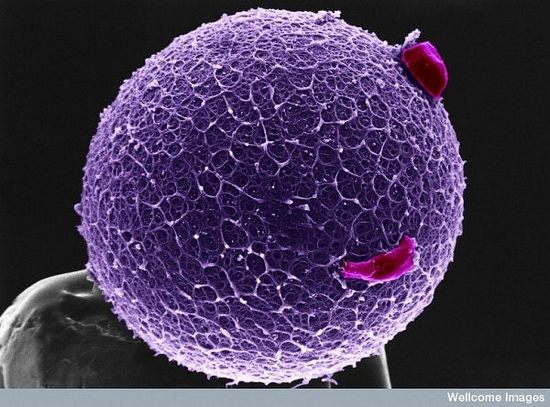 Человеческая яйцеклетка с корональными клетками